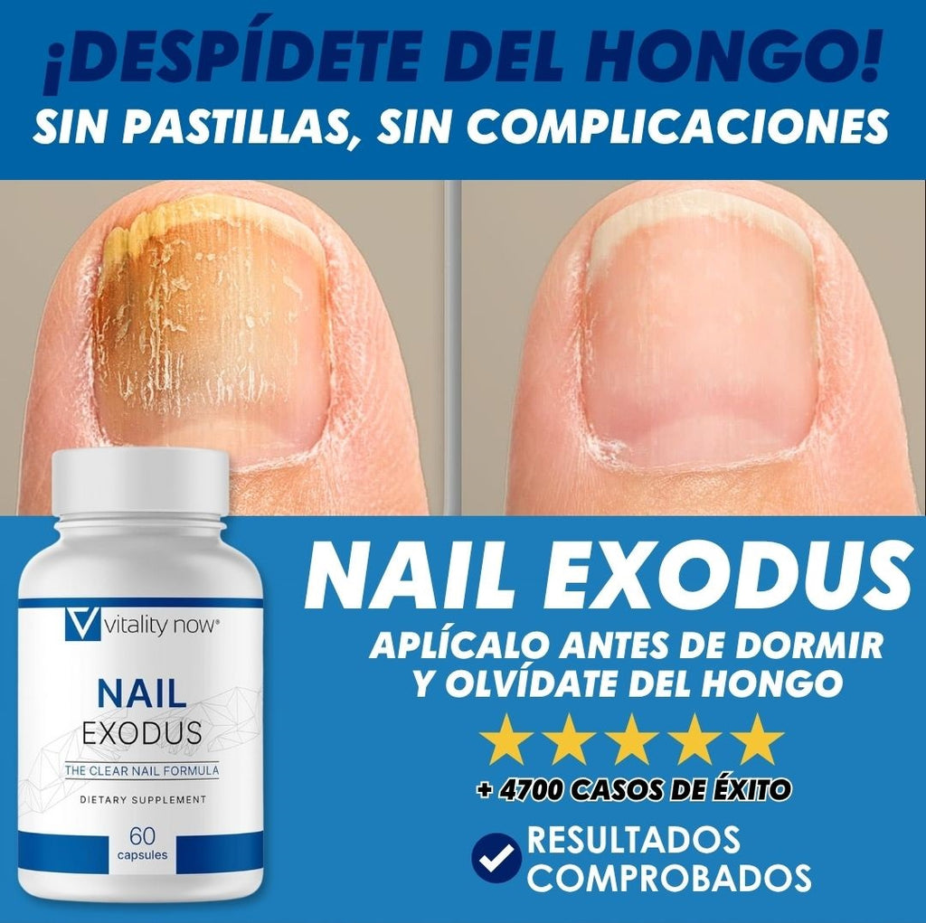 Nail Exodus® Tratamiento de Hongos de Uñas| Elimina Onicomicosis y Pie De Atleta